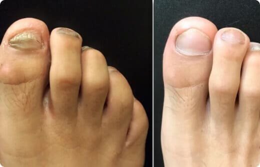 Another positive ClearNail testimonial